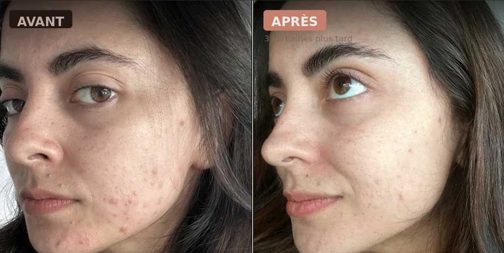 LumiFace Pro — Masque LED Thérapie 7 Couleurs